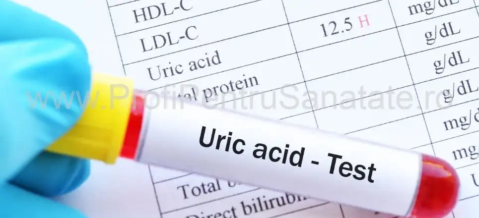Acidul uric: Importanța, Riscurile și Controlul Nivelurilor Sale