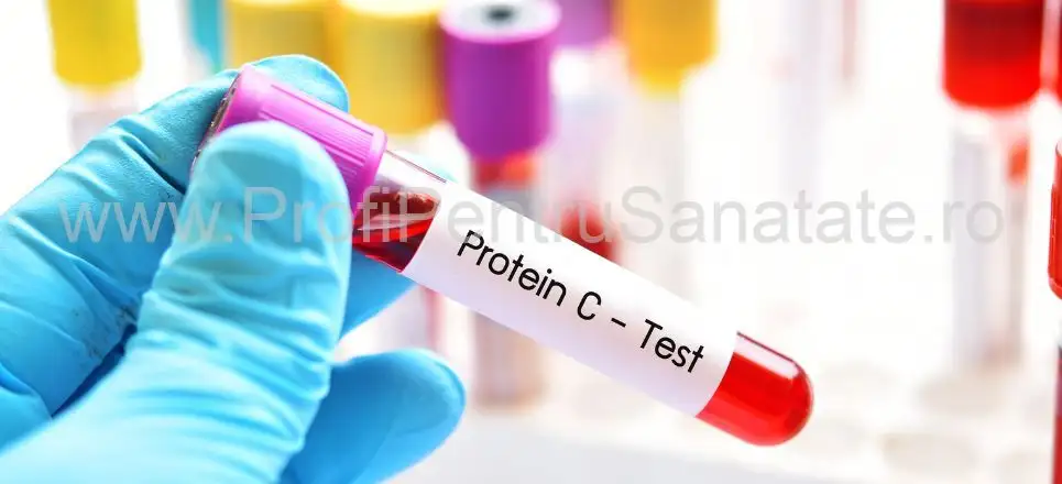 Proteina C reactivă: valori normale și cauze ale valorilor crescute
