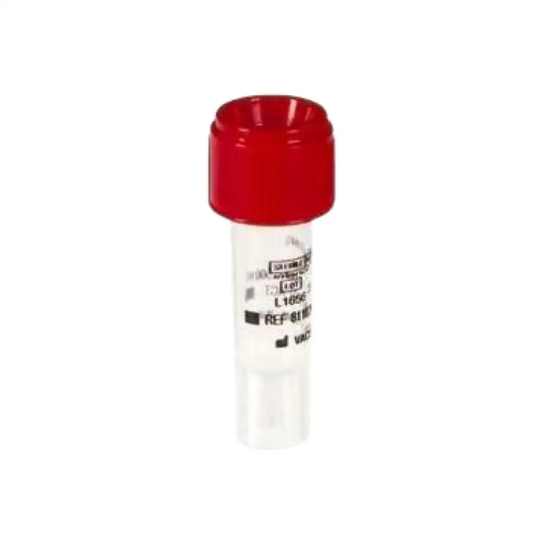 eprubeta tip vacutest rosie