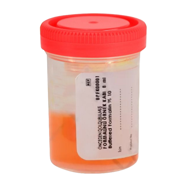 Recipient cu formol gata preparat - 25-30 ml