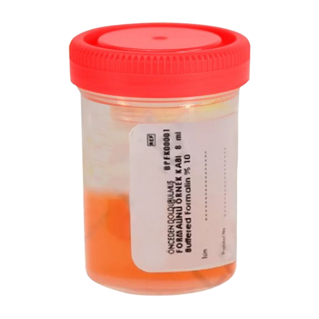 Recipient cu formol gata preparat- 8-15ml